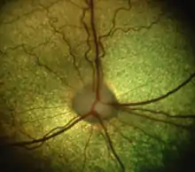 Image 38Dog retina showing optic disc and vasculature [epiCam] (from Dog anatomy)