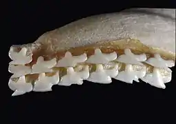 Upper teeth