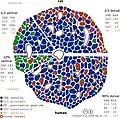 Structural differences between rat islets (top) and humans islets (bottom) as well as the ventral part (left) and the dorsal part (right) of the pancreas. Different cell types are colour-coded. Rodent islets, unlike the human ones, show the characteristic insulin core.