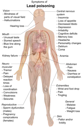 A chart of a human body with arrows pointing pieces of text to different parts of the body