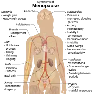 Diagram of human body showing parts affected by menopause