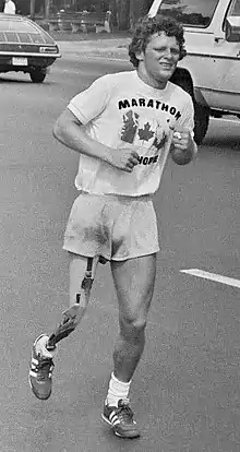 A young man with short, curly hair and an artificial right leg runs down a street. He wears shorts and a T-shirt that reads "Marathon of Hope"