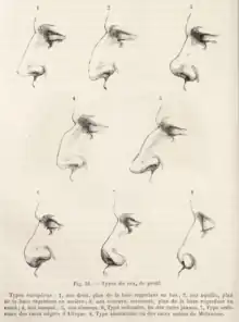 Image showing drawings of various nasal shapes.