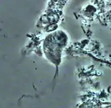 Parasite taken from the biofilm of a patient with chronic active periodontitis. Phase contrast microscope, 1000× magnification, salivary smear