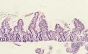 Tropical enteropathy, environmental enteric dysfunction