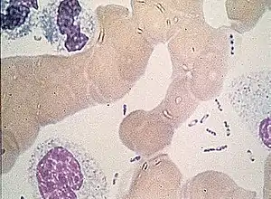 Blood smear taken from a patient with bubonic plague. Note the safety pin appearance of Yersinia pestis. Magnification ×1000. Wayson stain.