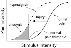 AMPS, pain amplification syndrome, juvenile fibromyalgia, childhood fibromyalgia